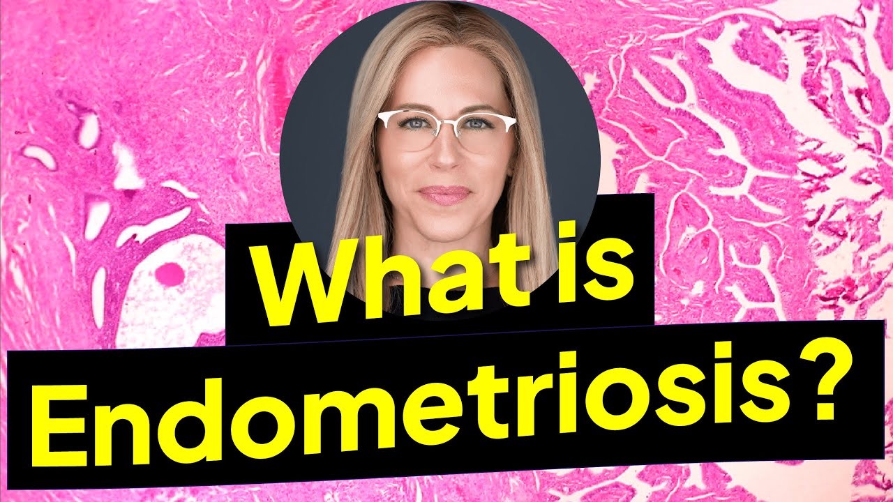 Video Thumbnail: What is ENDOMETRIOSIS?
