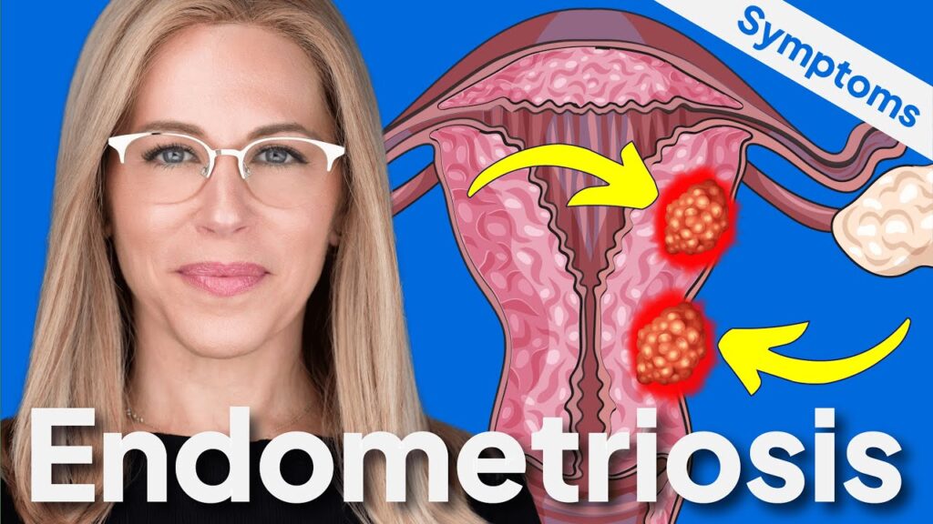 Video: 7 Signs You May Have Endometriosis 10 7 signs you may have endometrios