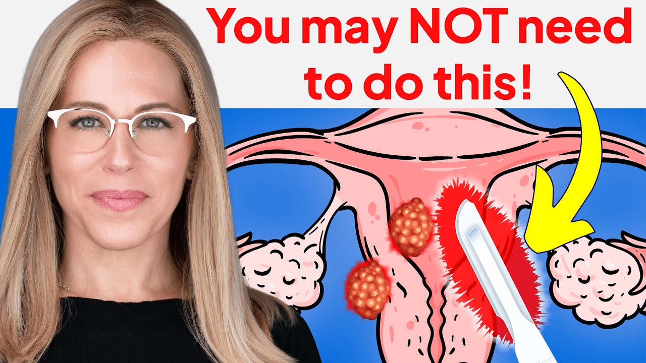 Video Thumbnail: Watch This Before You Get A Hysterectomy!