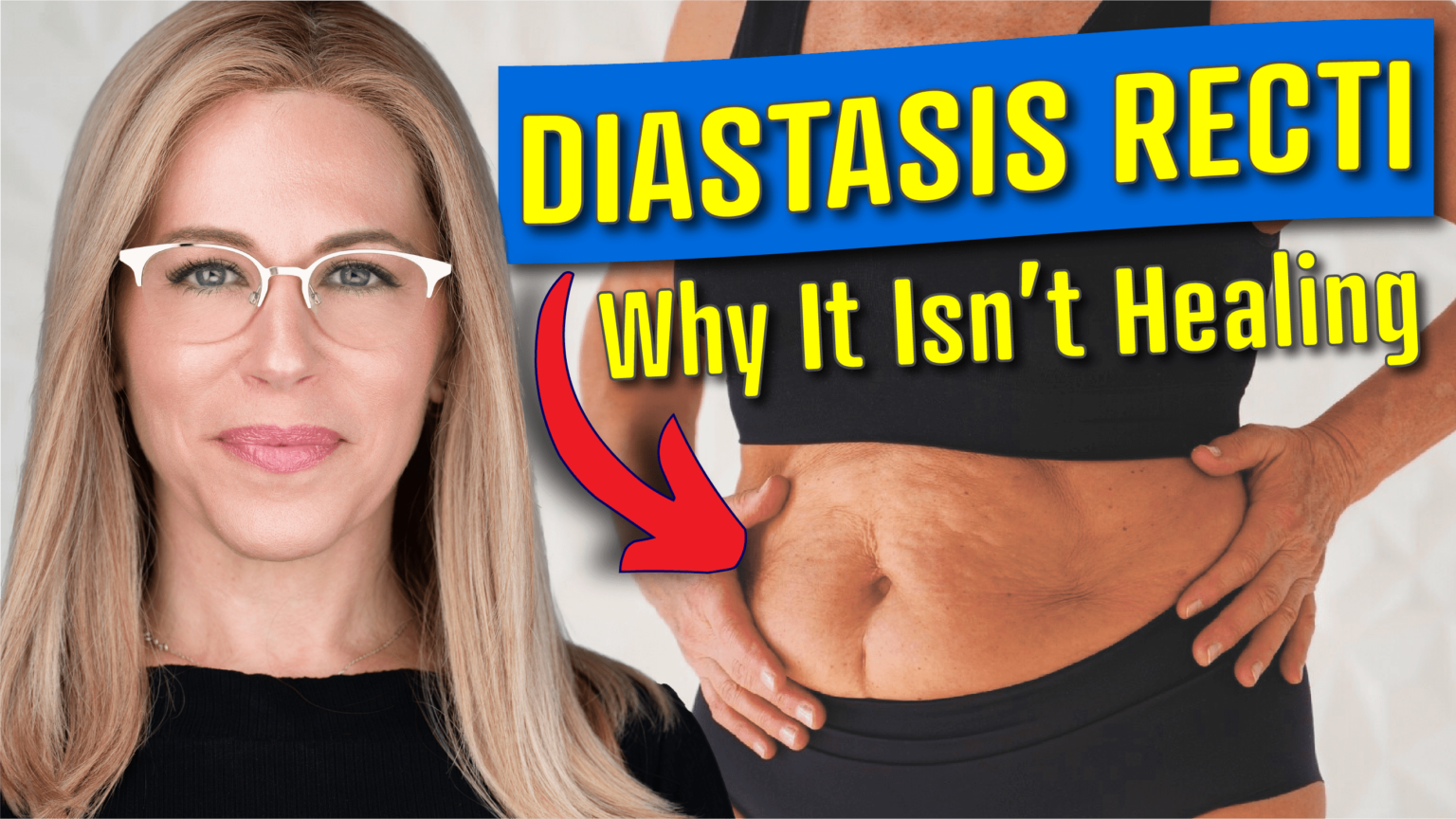 Diastasis Recti Thumbnail 2