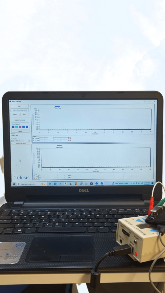 A dell laptop displaying the "telesis realtime" software interface on its screen, showing two graphs labeled "pelvis" and "abdomens" with time on the x-axis and measurement values on the y-axis. The graphs appear to be monitoring data in real-time, with flat lines indicating no current activity. Connected to the laptop via a usb cable is a beige electronic device with colored wires (red, green, and black) attached, likely a data acquisition or monitoring unit. The laptop is placed on a desk near a window with a partly cloudy sky visible in the background. The timestamp on the screen reads 11:07 am, february 20, 2023, and the weather is noted as "mostly cloudy, 74°f. "
