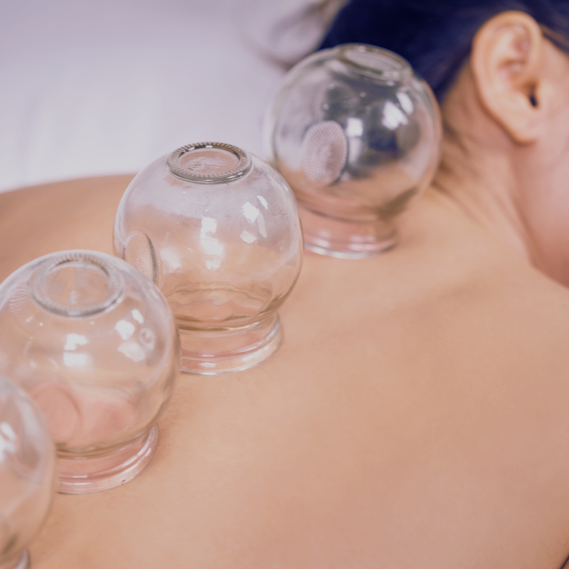 Cupping therapy - glass cups are placed on a person's back to create suction, a traditional practice believed to promote healing, relieve muscle tension, and improve blood flow.